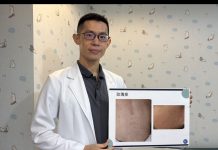 小小孩反覆高燒39、40度 若併「一症狀」小心玫瑰疹